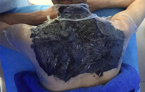 独创四联疗法专治肩周炎，7天康复！色情片
平阳部骨科火了！